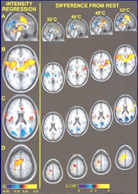 Sang, Maisog, Iadarola, J Neurophysiol