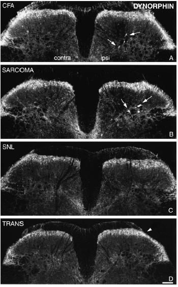 Confocal images illustrating the distribution of DYN-IR in laminae I II and III VI of the dorsal horn in coronal sections of the L4 spinal segment three days after CFA injection (A), 21 days after
