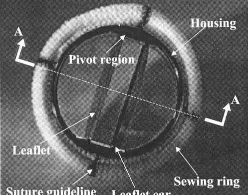 Bileaflet Disegno: Housing circondato da un anello ruotabile rivestito in tessuto fibroso artificiale e suddiviso in tre orifizi, uno centrale e due laterali, da due dischi semicircolari.