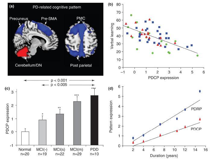 1 anni Trattati farmcologicamente MCI riduzione parietale e frontale (SPM), aumento cervelletto Aumento