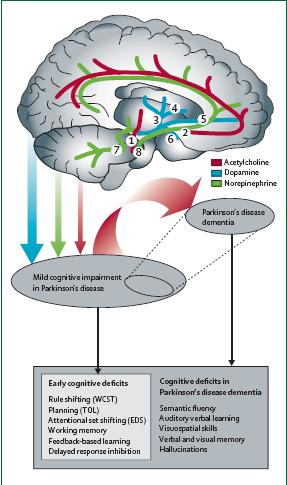 Sistemi di neurotrasmissione e disturbi cognitivi nel PD Sindrome frontale disesecutiva mediata nel MCI fase precoce: maggiormente dalla disfunzione DA disfunzione noradrenergica disfunzione