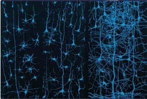 Il cervello dispone di circa 50-100 miliardi di neuroni (10 12 cellule nervose) con un numero di connessioni (sinapsi) che arriva a valori di trilioni di commessioni 10 18 = 10 12 * 10 6 Slide 15 di