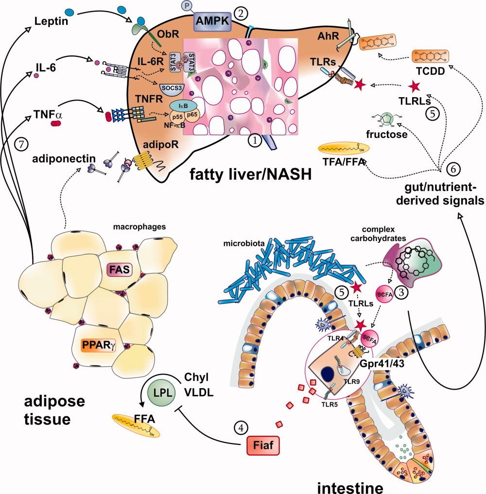 Evolution of inflammation in nonalcoholic fatty liver disease: The multiple parallel hits hypothesis 1. Accumulo lipidi, ossidazione previene lipotossicità -> fino a saturazione 2.