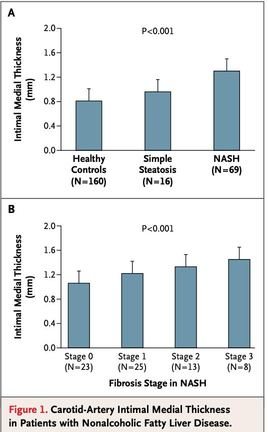 NAFLD e