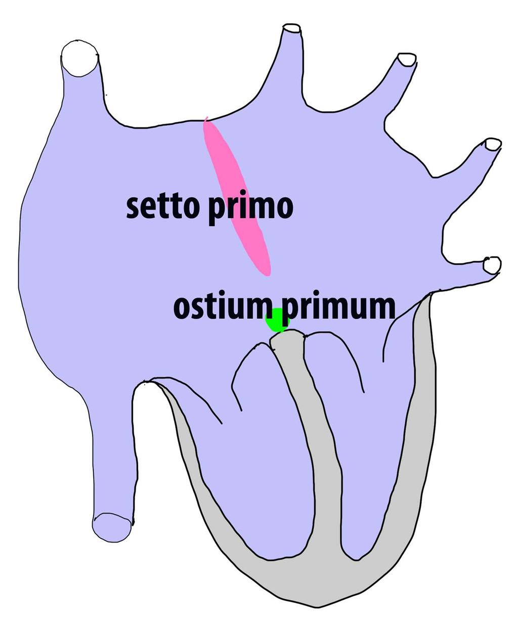 Settazione