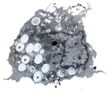 coinvolgono macrofagi e