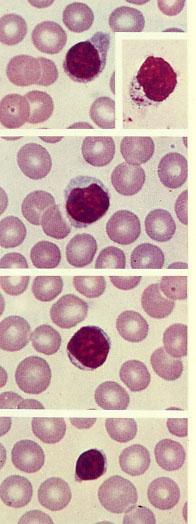 Linfociti del sangue 20-30% dei globuli bianchi In base alle dimensioni si dividono in piccoli (90%, diametro 6-8 m, grande nucleo tondo