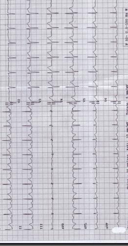 Alessio Controllo cardiologico con