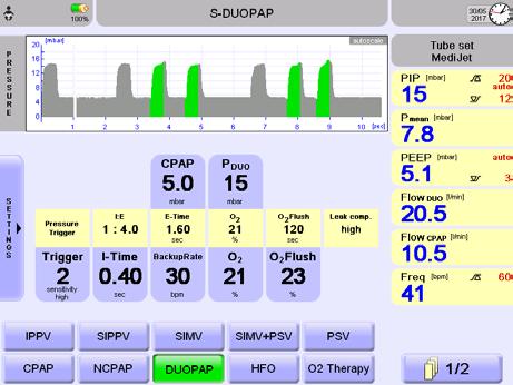 Rapid Shallow Breathing Index (RSBI), C20/C (indice Visualizzazione e rappresentazione chiara ed intuitiva di Tutte le procedure operative sono effettuate con il Le modalità di