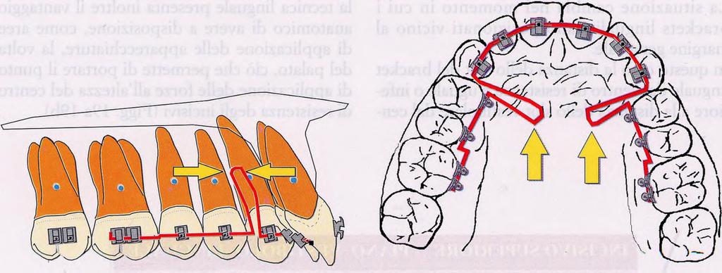 resistenza dei denti e se la zona di maggior lavoro della molla è rappresentata dalla sua parte