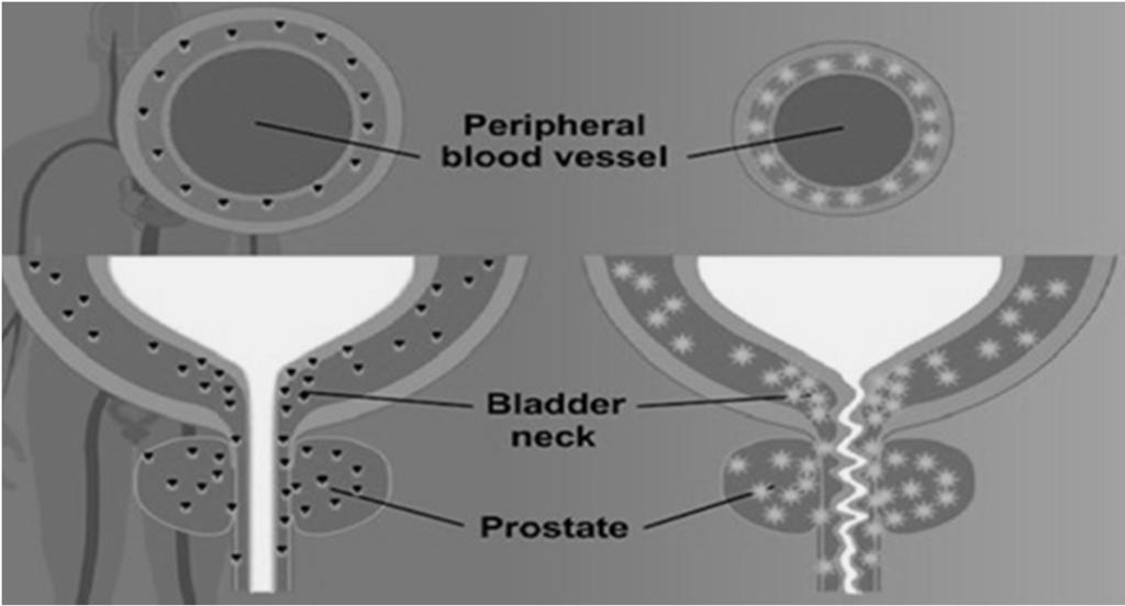 Recettori α1 a livello del collo della vescica e della prostata.