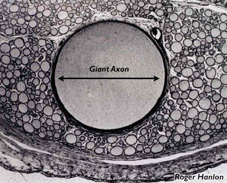 Registrazioni intracellulari (1950) Utilizzano un elettrodo di