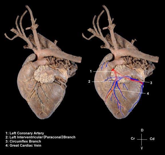 Dal BULBO AORTICO nascono le ARTERIE CORONARIE