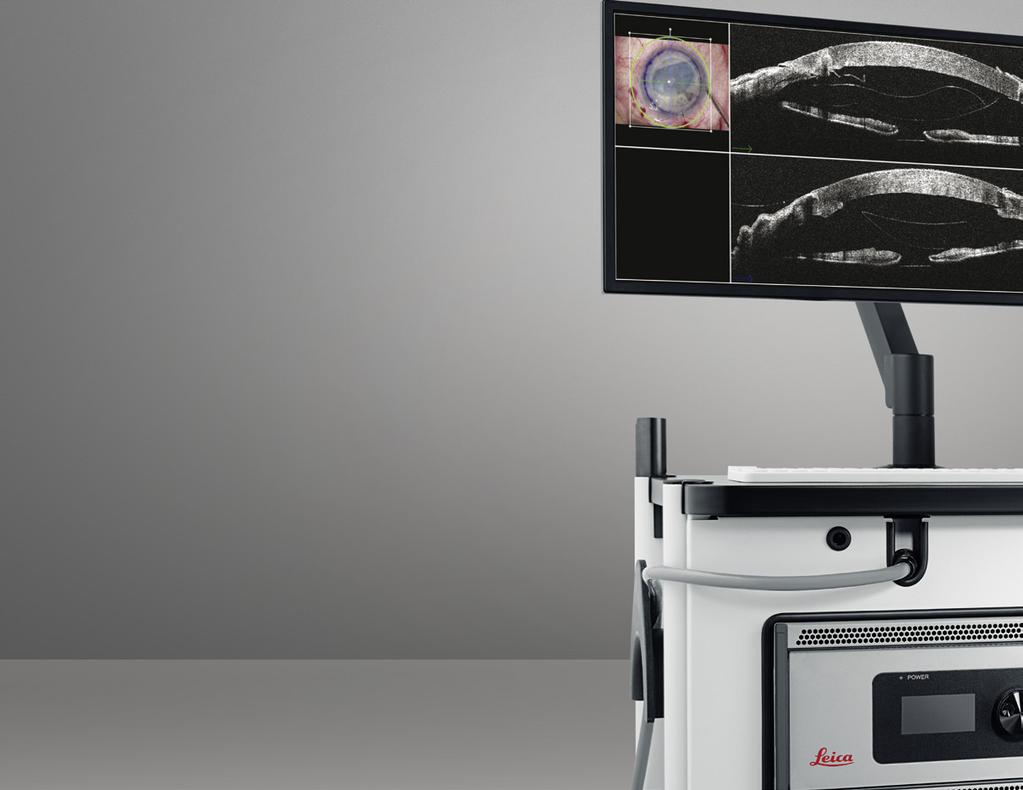 Ampio schermo LCD per un imaging OCT in tempo reale, visualizzazione dell immagine al microscopio e posizione della scansione OCT.