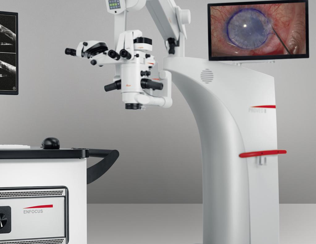 flusso di lavoro intelligente e le tecnologie ottiche rendono il microscopio Proveo 8 perfetto per le vostre esigenze in qualsiasi passaggio dell'intervento, senza doverlo interrompere > > Le