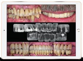 Implantoprotesi - Parodontologia Percorso Master Cod. Mod. IMPL.11 Il trattamento e la riabilitazione del paziente parodontale RELATORE PARTECIPANTI DURATA ORARIO QUOTA SEDE Prof.