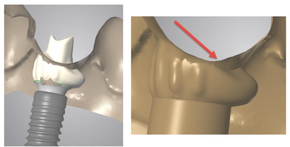 NOTA: Per utilizzare tutte le nuove funzioni Synergy, il vostro partner codiagnostix deve disporre di una versione del