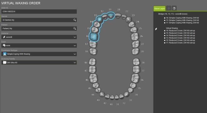 1.3 Flusso di lavoro di ceratura reale e virtuale NOTA: Solo per fresatura Straumann inlab e flusso di