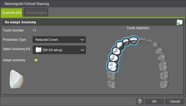 Usando il nuovo ordine di ceratura virtuale l utente CARES può realizzare ponti e restauri su denti che