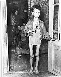 Effetti di deprivazione alimentare in utero (uomo) Nell inverno 1944-1945 i nazisti che occupavano i Paesi Bassi, bloccarono tutte le spedizioni di derrate alimentari