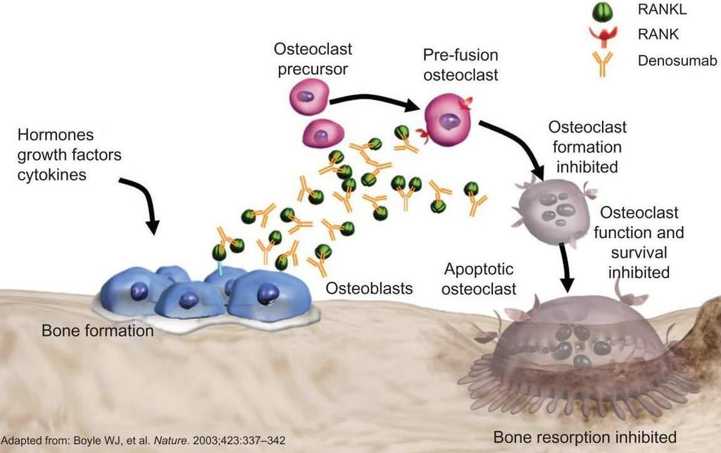 Denosumab