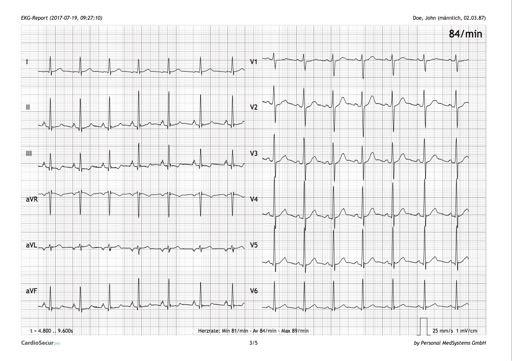 APPLICAZIONI Il cavo ECG incardio Plus si collega direttamente al tuo iphone o ipad.