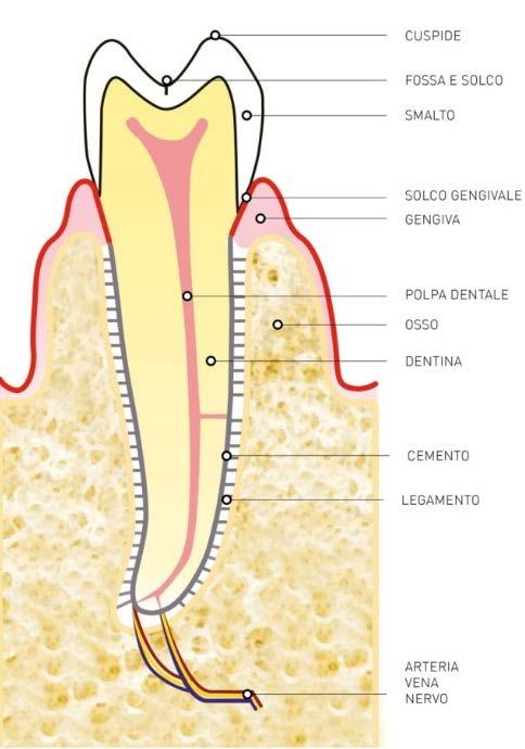 A sinistra: Parodontite iniziale associata a Gengivite (abbondante Placca Batterica Dentale, tartaro, gengive gonfie e sanguinanti).