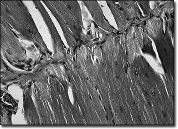 Cellule tessuto muscolare: elevato contenuto di mitocondri