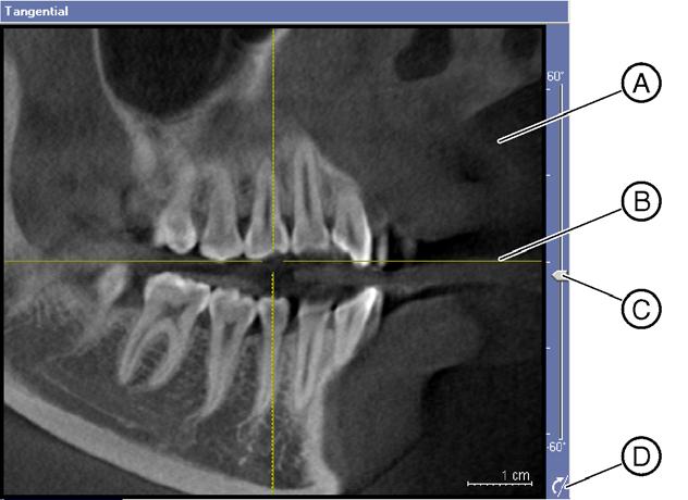 Viste Vista longitudinale Sirona Dental Systems GmbH 7.3 Vista longitudinale La vista longitudinale è costituita da una sezione verticale longitudinale rispetto alla finestra dell'esame.