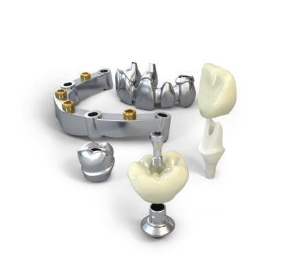 2 Panoramica generale Protesi CARES con tecnologia all'avanguardia Le protesi su impianti Straumann CARES forniscono soluzioni personalizzate per mancanza di denti singoli o multipli e arcate