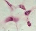 Per es: il DNA del batteriofago T4 ha una lunghezza di 60 x 10-6 metri, mentre la testa ha un diametro pari a 80 x 10-9 metri.