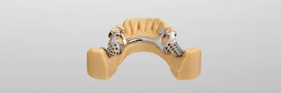 PROTESI DENTARIE MOBILI Protesi dentarie mobili con un eccellente precisione di adattamento Perché continuare con la fusione quando sono disponibili metodi digitali?