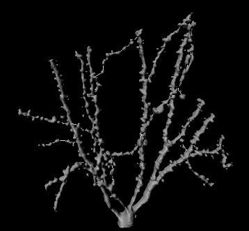 Analisi di filamenti Soglia intensità di fluorescenza Calcolo