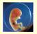 La questione degli embrioni crioconservati all'interno del processo di procreazione medicalmente assistita. Introduzione alle problematiche etiche.
