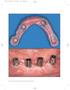 Rivista Internazionale di Parodontologia & Odontoiatria Ricostruttiva