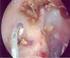 TESSUTO EPITELIALE. l interno dell orecchio, le cavità del corpo non a contatto con l esterno, i vasi sanguigni e linfatici