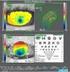 Ottica della Contattologia I. La aberrazioni. L aberrazione cromatica. L aberrazione cromatica