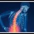Osteoporosi. L osteoporosi è una malattia diffusa di tutto lo scheletro ed è caratterizzata da riduzione
