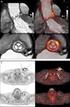 La tecnica Single Photon Emission Computed Tomography (SPECT)