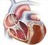 La terapia di risincronizzazione cardiaca