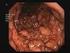 Morbo di Crohn : basi immunitarie e meccanismi patogenetici. Fiorito Veronica B iotecnologie Molecolari Anno Accademico