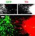 Connessioni. Le cellule cardiache sono unite tra loro da parti più ispessite del sarcolemma dette: Gap - junction