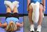 Artrite: gli esercizi fisici che riducono il dolore