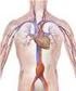 La causa più frequente di aneurisma aortico è l'aterosclerosi, che interessa principalmente l'aorta addominale. Tipicamente le dilatazioni
