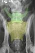 Recenti sviluppi nella mielografia lombare nel cane*