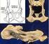 Le osteotomie di bacino in età adulta