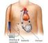 Programma di Assistenza Cardiaca Meccanica