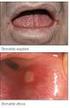 Le patologie autoimmunitarie del cavo orale