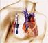 L ipertensione arteriosa nell uremico in emodialisi: importanza dell intake di sale