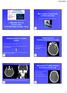 Nel sospetto di patologia cerebrovascolare L IMAGING NELLA PATOLOGIA CEREBROVASCOLARE OGGI. Segni precoci lesione ischemica (1-3 ore)